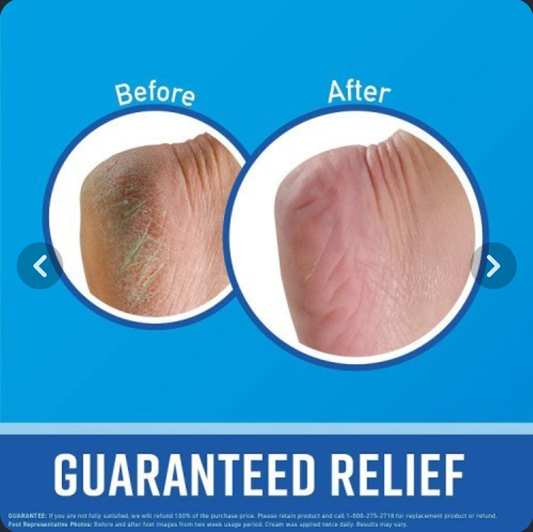 کرم ترک پای قوی اوکیفس(O'Keeffe's) آمریکا حجم 91 میل