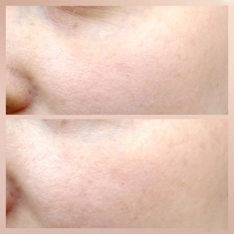 فوم ژل شستشوی صورت سنسیبیو بایودرما مخصوص پوست حساس و خشک tBioderma Sensibio Gel Moussan