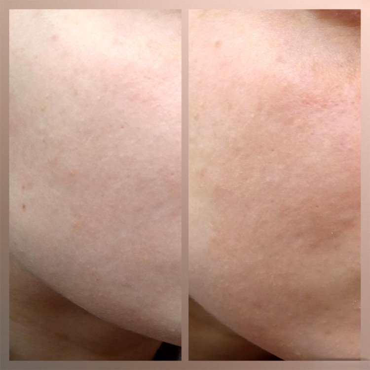 فوم ژل شستشوی صورت سنسیبیو بایودرما مخصوص پوست حساس و خشک tBioderma Sensibio Gel Moussan